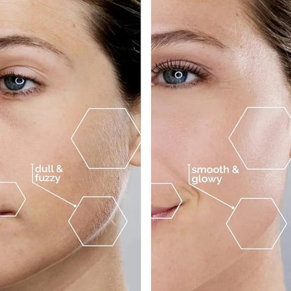 Facial Hair Remover For Men & Women USB RECHARGEABLE